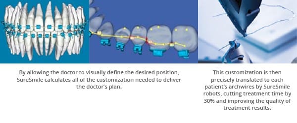 SureSmile® Braces in Atlanta and Marietta, GA